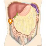 Right paracolic gutter